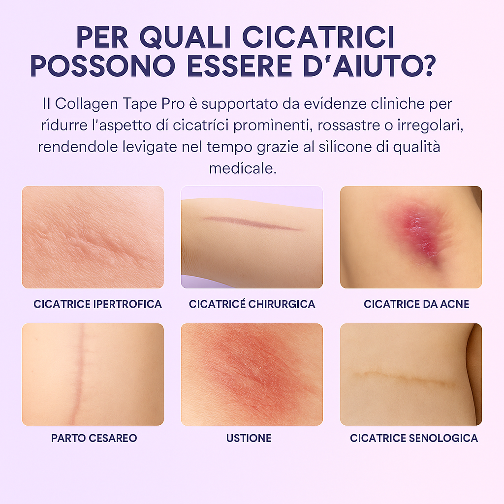 DermaCollagen Tape – Nastro Rigenerante per Rughe e Cicatrici