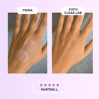 DermaCollagen Tape – Nastro Rigenerante per Rughe e Cicatrici