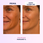 DermaCollagen Tape – Nastro Rigenerante per Rughe e Cicatrici