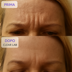 DermaCollagen Tape – Nastro Rigenerante per Rughe e Cicatrici